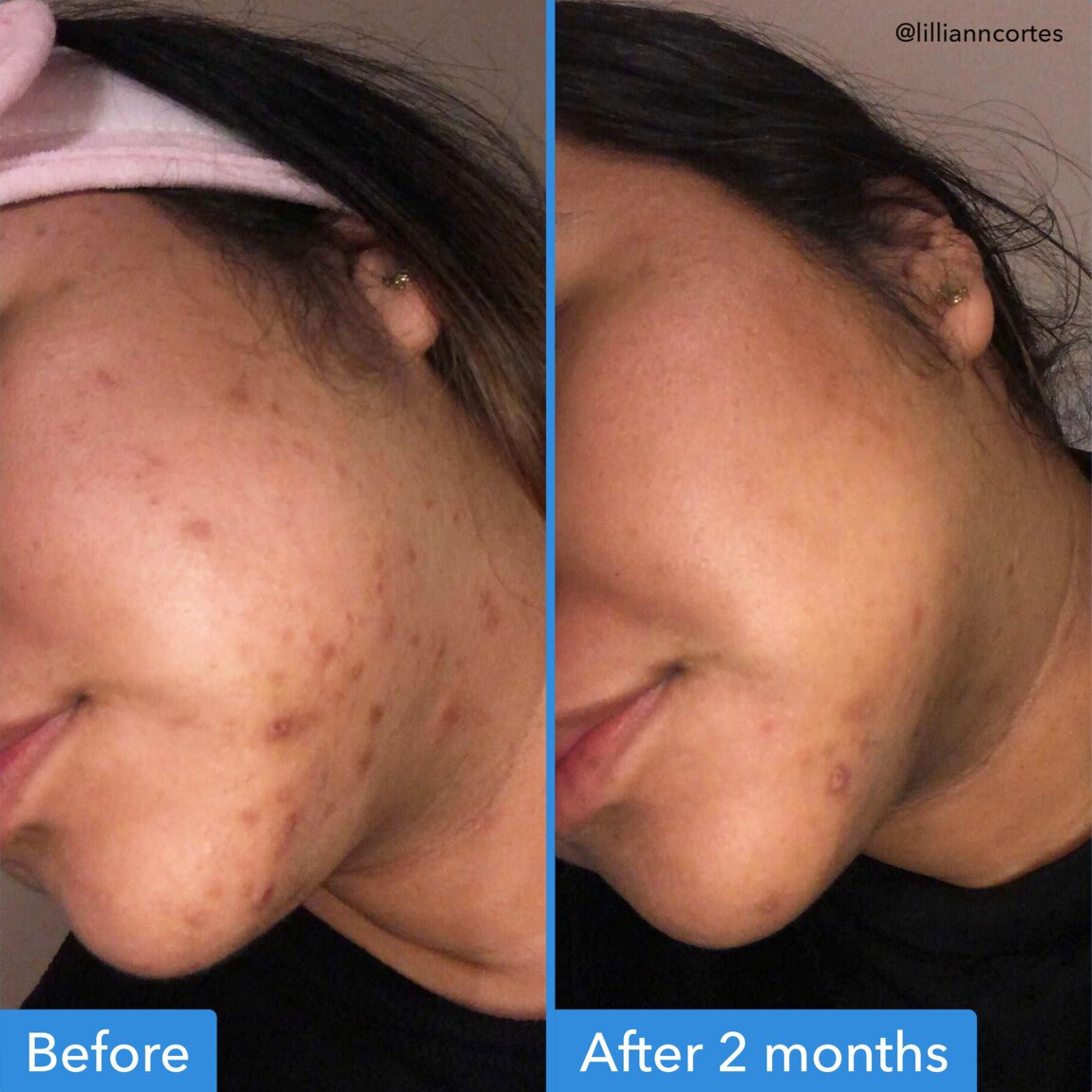 discoloration-correcting-serum-w9 zb_p.jpg