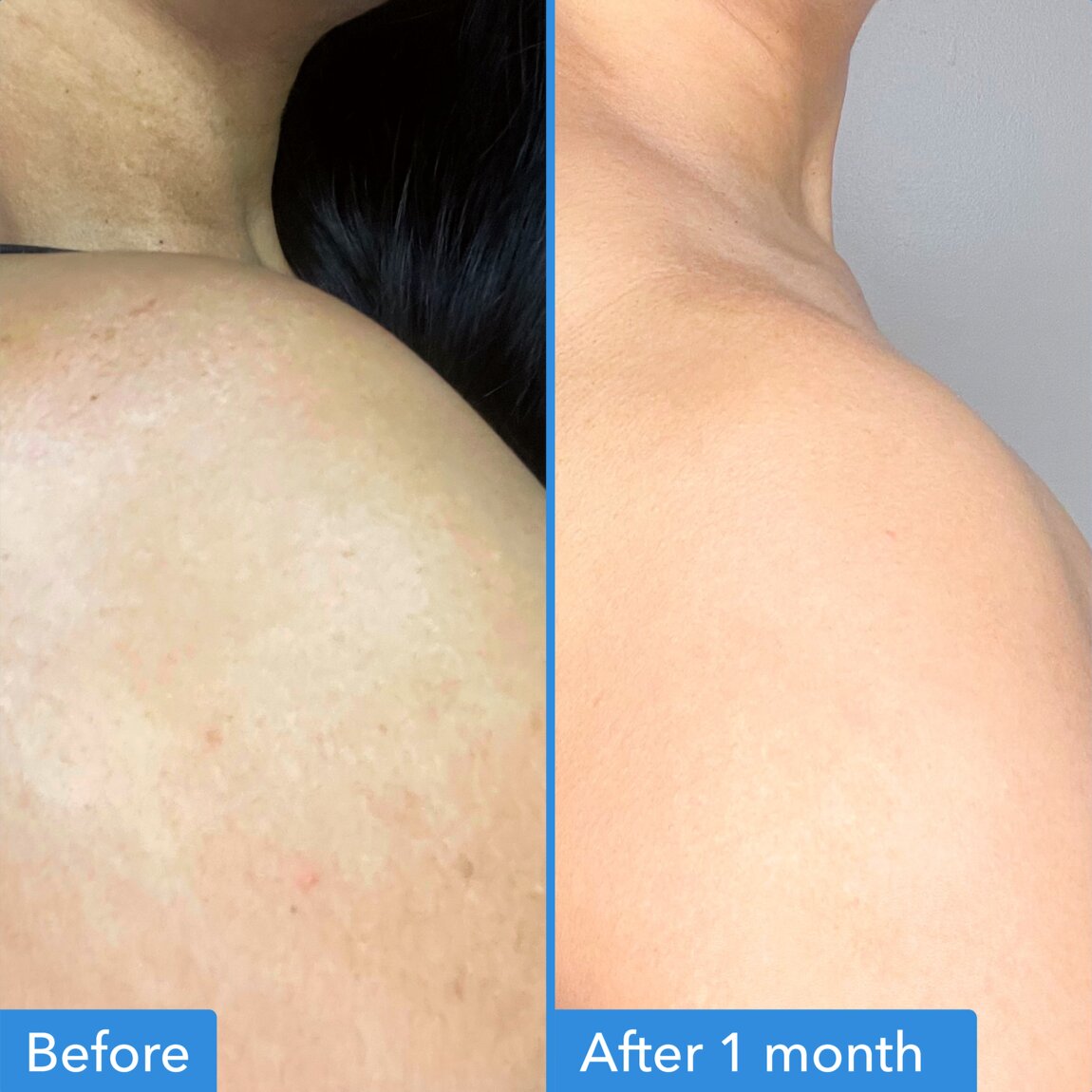 discoloration-correcting-body-treatment-w5 zb_p.jpg