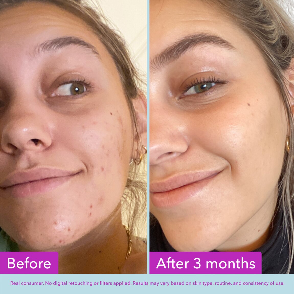 niacinamide-brightening-toner-p4 zb_p.jpg